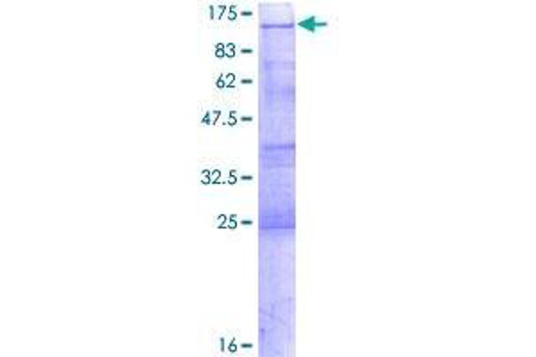 YTHDC1 Protein (AA 1-709) (GST tag)