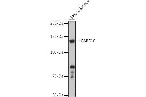 Western blot analysis of extracts of Mouse kidney, using C antibody (ABIN6127549, ABIN6137937, ABIN6137938 and ABIN6223226) at 1:500 dilution. (CARD10 antibody  (AA 863-1032))