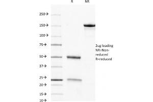 SDS-PAGE Analysis Purified CD8 Mouse Monoclonal Antibody (C8/468).