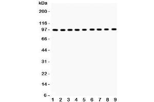 Western blot testing of GR antibody and Lane 1:  rat liver;  2: (r) brain;  3: (r) spleen;  4: human placenta;  5: (h) SMMC;  6: mouse HEPA;  7: (m) Neuro-2a;  8: (h) HeLa;  9: (r) PC12;  Predicted/Observed size: 91~94KD (GR (AA 20-199) antibody)