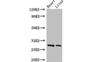 Western Blot Positive WB detected in: Mouse heart tissue, Mouse liver tissue All lanes: SPIC antibody at 3. (SPIC antibody  (AA 1-248))