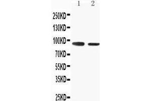 Anti-SLC9A2 antibody, Western blotting Lane 1: Rat Skeletal Musle Tissue Lysate Lane 2: Rat Kidney Tissue Lysate