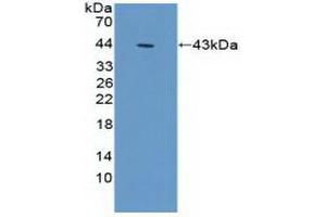 Detection of Recombinant ACTg1, Human using Polyclonal Antibody to Gamma Actin (ACTG) (Actin, gamma 1 antibody  (AA 1-375))
