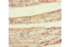Immunohistochemistry of paraffin-embedded human heart tissue using ABIN7142008 at dilution of 1:100 (PDK4 antibody  (AA 143-333))