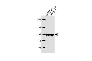 All lanes : Anti-AFTPH Antibody (C-term) at 1:2000 dilution Lane 1: CCRF-CEM whole cell lysate Lane 2: MCF-7 whole cell lysate Lysates/proteins at 20 μg per lane.
