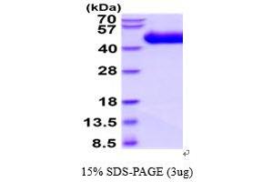 SDS-PAGE (SDS) image for Interleukin 1 Receptor-Like 1 (IL1RL1) (AA 19-328) protein (His tag) (ABIN5854643)