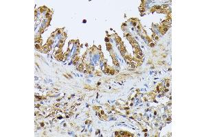 Immunohistochemistry of paraffin-embedded rat lung using SMN1 antibody (ABIN7270652) at dilution of 1:100 (40x lens). (SMN1 antibody  (AA 80-150))