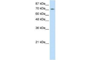 Western Blot showing ZNF527 antibody used at a concentration of 1-2 ug/ml to detect its target protein. (ZNF527 antibody  (C-Term))