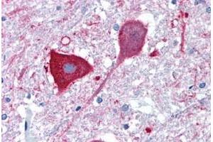 Immunohistochemical staining of human brain, medulla with MRGPRD polyclonal antibody . (MRGPRD antibody  (Extracellular Domain))