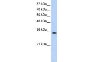 Western Blotting (WB) image for anti-Muscleblind-like Protein 1 (MBNL1) antibody (ABIN2462371) (MBNL1 antibody)