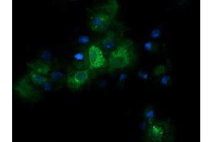 Image no. 3 for anti-Retinoic Acid Receptor Responder (Tazarotene Induced) 1 (RARRES1) antibody (ABIN1500602) (RARRES1 antibody)