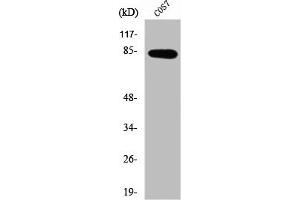Western Blot analysis of Jurkat cells using SEMA4A Polyclonal Antibody (Sema4a antibody  (Internal Region))