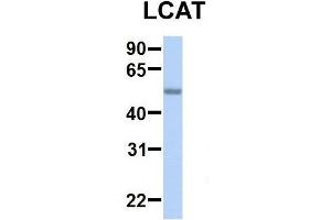 Host:  Rabbit  Target Name:  SERPINA3  Sample Type:  Human Adult Placenta  Antibody Dilution:  1. (LCAT antibody  (C-Term))