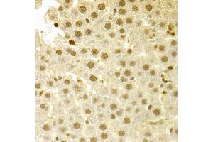 Immunohistochemistry of paraffin-embedded human liver injury using SFN Antibody. (14-3-3 sigma/SFN antibody  (AA 1-248))