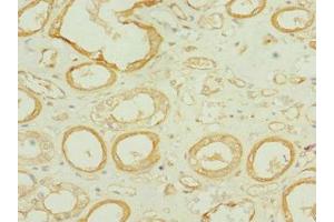 Immunohistochemistry of paraffin-embedded human kidney tissue using ABIN7171688 at dilution of 1:100 (Tektin 3 antibody  (AA 201-400))