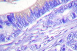 Image no. 2 for anti-Breast Cancer Anti-Estrogen Resistance 1 (BCAR1) antibody (ABIN271903) (BCAR1 antibody)