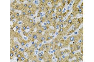 Immunohistochemistry of paraffin-embedded Human liver damage using SDC4 Polyclonal Antibody at dilution of 1:100 (40x lens). (SDC4 antibody)
