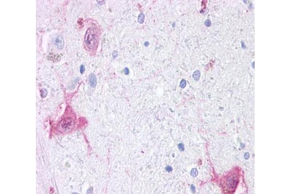 GPR6 antibody  (Cytoplasmic Domain)