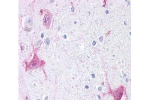 Anti-GPR6 antibody  ABIN1048844 IHC staining of human brain, neurons and glia. (GPR6 antibody  (Cytoplasmic Domain))