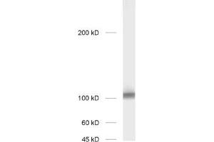 dilution: 1 : 1000; sample: rat hippocampus homogenate (GRIA2 antibody  (AA 278-292))