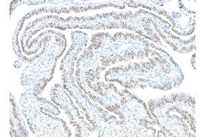 Immunohistochemistry (IHC) image for anti-Paired Box 8 (PAX8) antibody (ABIN7795602) (PAX8 antibody)