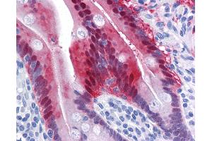 Anti-AKR1B10 antibody IHC of human small intestine. (AKR1B10 antibody  (AA 76-144))