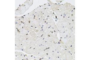 Immunohistochemistry of paraffin-embedded mouse heart using GTF2H2 antibody (ABIN5975366) at dilution of 1/100 (40x lens). (GTF2H2 antibody)