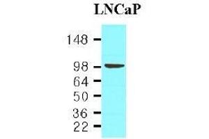 Western Blotting (WB) image for anti-Folate Hydrolase (Prostate-Specific Membrane Antigen) 1 (FOLH1) (AA 117-351) antibody (ABIN317555) (PSMA antibody  (AA 117-351))