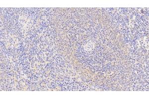 Detection of S100Z in Human Spleen Tissue using Polyclonal Antibody to S100 Calcium Binding Protein Z (S100Z) (S100Z antibody  (AA 1-99))