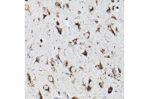 Immunohistochemistry of paraffin-embedded mouse brain using PSAP Rabbit pAb (ABIN3022605, ABIN3022606, ABIN3022607, ABIN1513432 and ABIN6218938) at dilution of 1:100 (40x lens).