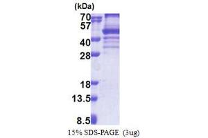 SDS-PAGE (SDS) image for EBNA1 Binding Protein 2 (EBNA1BP2) (AA 1-306) protein (His tag) (ABIN5853242)