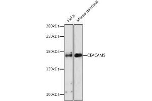 Western blot analysis of extracts of various cell lines, using CE antibody (ABIN3021184, ABIN3021185, ABIN3021186, ABIN1512752 and ABIN6214055) at 1:1000 dilution. (CEACAM5 antibody)