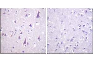 Immunohistochemistry analysis of paraffin-embedded human brain, using GFAP (Phospho-Ser38) Antibody.
