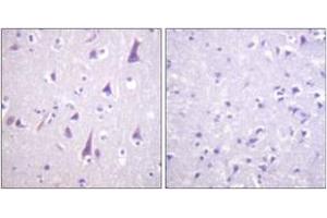 Immunohistochemistry analysis of paraffin-embedded human brain, using GFAP (Phospho-Ser38) Antibody. (GFAP antibody  (pSer38))