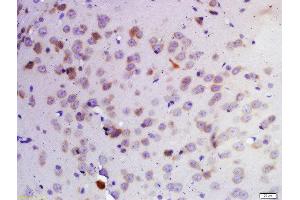 Formalin-fixed and paraffin embedded rat brain labeled with Rabbit Anti-KDM1 Polyclonal Antibody, Unconjugated 1:200 followed by conjugation to the secondary antibody and DAB staining (LSD1 antibody  (AA 101-200))
