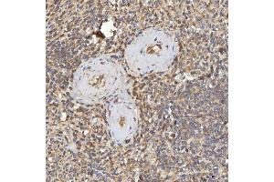 IHC analysis of RBMS1 using anti-RBMS1 antibody (ABIN7601195).