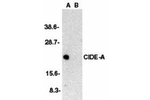 Western Blotting (WB) image for anti-Cell Death-Inducing DFFA-Like Effector A (CIDEA) (C-Term) antibody (ABIN1030333) (CIDEA antibody  (C-Term))
