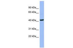 Image no. 1 for anti-serpin Peptidase Inhibitor, Clade B (Ovalbumin), Member 13 (SERPINB13) (AA 107-156) antibody (ABIN6741692) (SERPINB13 antibody  (AA 107-156))
