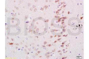 Formalin-fixed and paraffin embedded mouse brain labeled with Rabbit Anti Neurocan Polyclonal Antibody, Unconjugated (ABIN737001) at 1:200 followed by conjugation to the secondary antibody and DAB staining (Neurocan antibody  (AA 1185-1257))