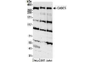 Western Blotting (WB) image for anti-Cancer Susceptibility Candidate 5 (CASC5) (AA 300-350) antibody (ABIN7450069)