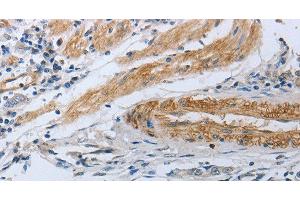 NPR1 antibody
