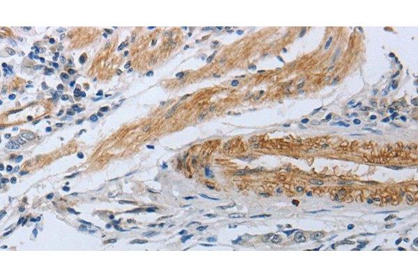NPR1 antibody