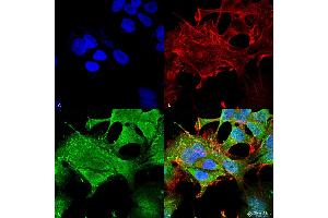 Immunocytochemistry/Immunofluorescence analysis using Mouse Anti-Notch1 Monoclonal Antibody, Clone S253-32 . (Notch1 antibody  (AA 20-216) (APC))