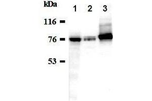 Western Blotting (WB) image for anti-Sodium Potassium ATPase, alpha1 (ATP1A1) antibody (ABIN1449189)