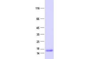 Western Blotting (WB) image for Ets Variant 3 (ETV3) protein (His tag) (ABIN2720584)