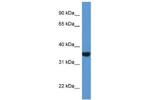 WB Suggested Anti-NQO1 AntibodyTitration: 1. (NQO1 antibody  (C-Term))