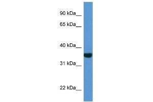 Western Blotting (WB) image for anti-NAD(P)H Dehydrogenase, Quinone 1 (NQO1) (C-Term) antibody (ABIN2788701)