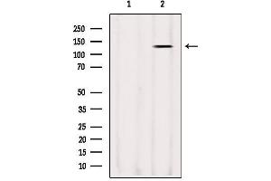 Western blot analysis of extracts from Sp2/0, using LRPPRC Antibody. (LRPPRC antibody  (Internal Region))