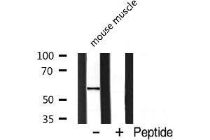 Western blot analysis of extracts from mouse brain, using Cytochrome P450 19A1 antibody. (Aromatase antibody  (Internal Region))