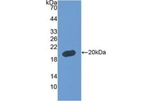 Detection of Recombinant FBLN5, Human using Polyclonal Antibody to Fibulin 5 (FBLN5) (Fibulin 5 antibody  (AA 99-205))